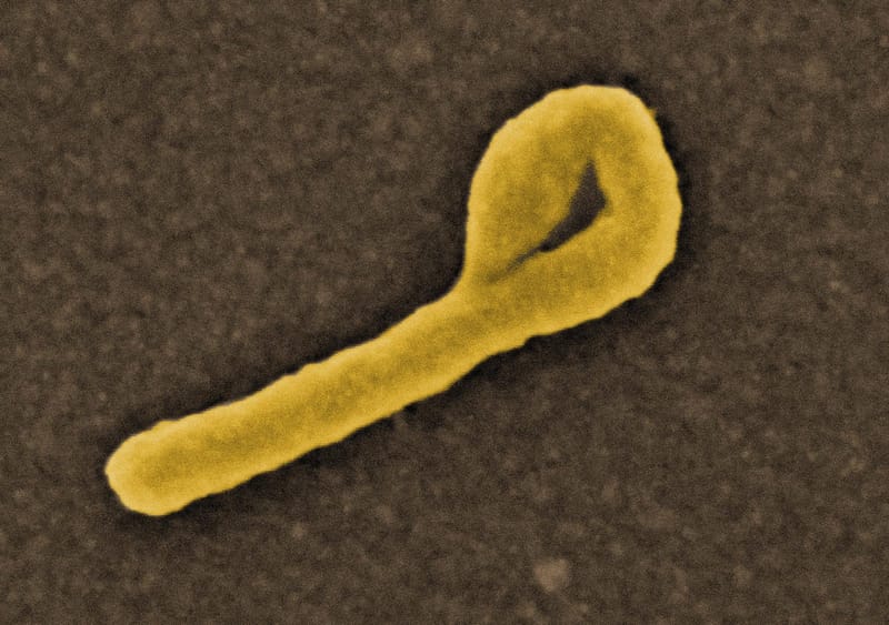 Micrografia eletrônica de varredura colorizada de partículas do vírus ebola brotando da superfície de uma célula cultivada